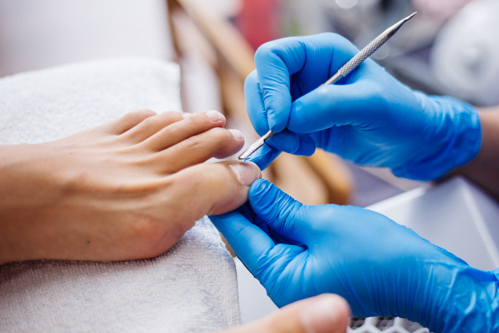 specialist wearing blue gloves is carefully trimming and treating the toenails of a client to address nail fungus, emphasizing proper foot care in the process.